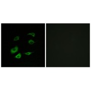 Immunofluorescence analysis of HepG2 cells, using Cyclosome 1 antibody.