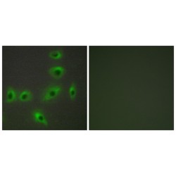 Bcl2 Associated X Protein (BAX) Antibody