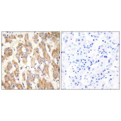 Bcl2 Associated X Protein (BAX) Antibody