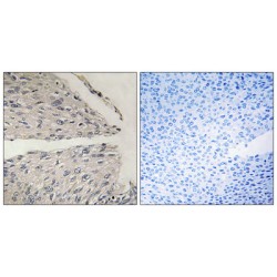 Cell Death-Inducing DFFA-Like Effector B (CIDEB) Antibody