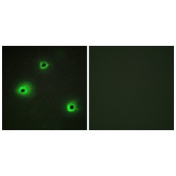 Granzyme H (GZMH) Antibody