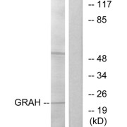 Western blot analysis of extracts from K562 cells, using GRAH antibody.