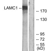 Western blot analysis of extracts from HUVEC cells, using LAMC1 antibody.