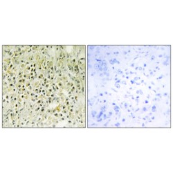 Galectin-8 (LEG8) Antibody