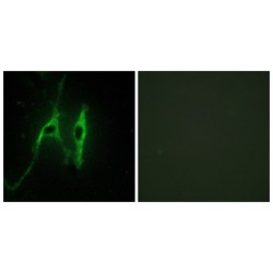 Cytochrome B5 (CYB5) Antibody