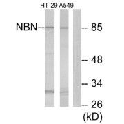 Western blot analysis of extracts from HT-29 cells and A549 cells, using NBN antibody.