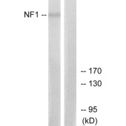 Western blot analysis of extracts from HepG2 cells, using NF1 antibody.