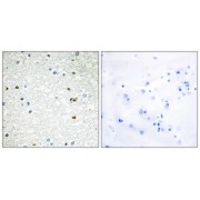 Immunohistochemistry analysis of paraffin-embedded human brain tissue using PARP3 antibody.