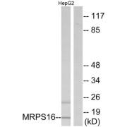 Western blot analysis of extracts from HepG2 cells, using MRPS16 antibody.