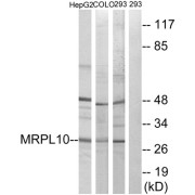 Western blot analysis of extracts from HepG2 cells, COLO cells and 293 cells, using MRPL10 antibody.