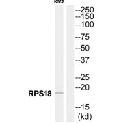 Western blot analysis of extracts from K562 cells, using RPS18 antibody. The lane on the right is treated with the synthetic peptide.