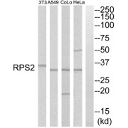 Western blot analysis of extracts from HeLa cells, A549 cells, COLO205 cells and NIH-3T3 cells, using RPS2 antibody.