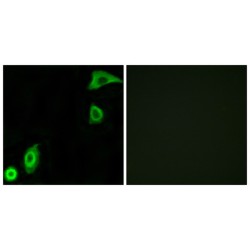 Small Ribosomal Subunit Protein uS10 (RPS20) Antibody