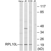 Western blot analysis of extracts from HeLa cells, Jurkat cells and COS7 cells, using RPL10L antibody.