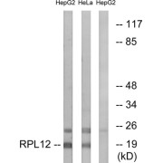 Western blot analysis of extracts from HepG2 cells and HeLa cells, using RPL12 antibody.