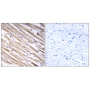 Immunohistochemistry analysis of paraffin-embedded human heart tissue using RPL3L antibody.