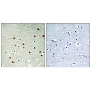 Immunohistochemistry analysis of paraffin-embedded human brain tissue using ABHD14B antibody.