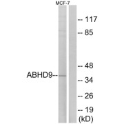 Western blot analysis of extracts from MCF-7 cells, using ABHD9 antibody.