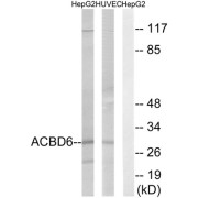 Western blot analysis of extracts from HepG2 cells and HUVEC cells, using ACBD6 antibody.