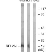 Western blot analysis of extracts from HUVEC cells and MCF-7 cells, using RPL26L antibody.