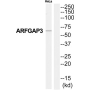 ADP-Ribosylation Factor GTPase Activating Protein 3 (ARFGAP3) Antibody