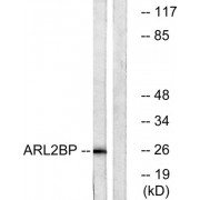 Western blot analysis of extracts from A549 cells, using ARL2BP antibody.