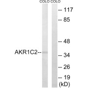 Western blot analysis of extracts from COLO cells, using AKR1C2 antibody.