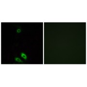 Immunofluorescence analysis of A549 cells, using AKR1CL1 antibody.