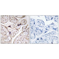 Alkaline Ceramidase 3 (ACER3) Antibody