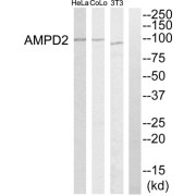 Western blot analysis of extracts from HeLa cells, NIH-3T3 cells and COLO205 cells, using AMPD2 antibody.