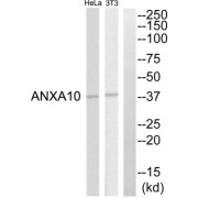 Western blot analysis of extracts from HeLa cell and NIH-3T3 cells, using ANXA10 antibody.