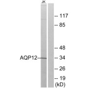 Western blot analysis of extracts from Jurkat cells, using AQP12 antibody.