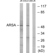 Western blot analysis of extracts from Jurkat cells and COLO cells, using ARSA antibody.