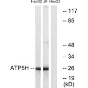 Western blot analysis of extracts from HepG2 cells and Jurkat cells, using ATP5H antibody.