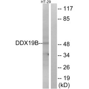 Western blot analysis of extracts from HT-29 cells, using DDX19B antibody.