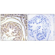 Immunohistochemistry analysis of paraffin-embedded human testis tissue using BAGE2 antibody.