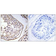 Immunohistochemistry analysis of paraffin-embedded human testis tissue using BAGE3 antibody.