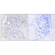 Immunohistochemistry analysis of paraffin-embedded human thyroid gland tissue using C9orf89 antibody.