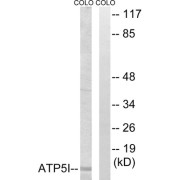 Western blot analysis of extracts from COLO cells, using ATP5I antibody.