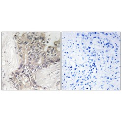 Beta-1,3-Glucosyltransferase (B3GALTL) Antibody