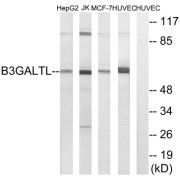 Western blot analysis of extracts from HepG2 cells, Jurkat cells, MCF-7 cells and HUVEC cells, using B3GALTL antibody.