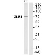 Western blot analysis of extracts from 3T3 cells, using GLB1 antibody.