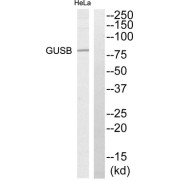 Western blot analysis of extracts from HeLa cells, using GUSB antibody.