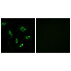 Bile Acyl-CoA Synthetase (SLC27A5) Antibody