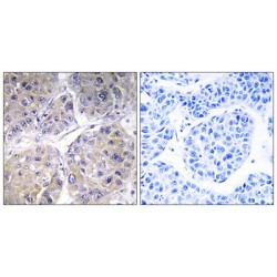 Bile Acyl-CoA Synthetase (SLC27A5) Antibody