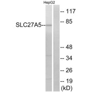 Western blot analysis of extracts from HepG2 cells, using SLC27A5 antibody.