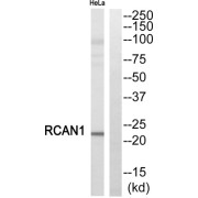 Western blot analysis of extracts from HeLa cells, using RCAN1 antibody.