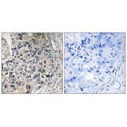 Immunohistochemistry analysis of paraffin-embedded human prostate carcinoma tissue using CMC1 antibody.