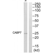 Western blot analysis of extracts from Jurkat cells, using CABP7 antibody.