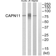 Western blot analysis of extracts from HepG2 cells, Jurkat cells and HuvEc cells, using CAPN11 antibody.